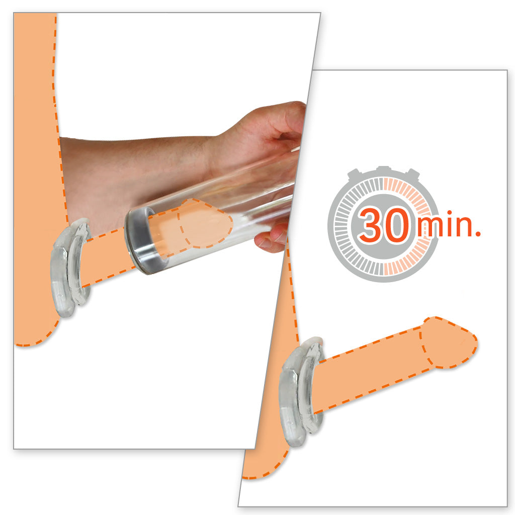 Spartan Medical-Grade Penis Pump Instructions Step 10